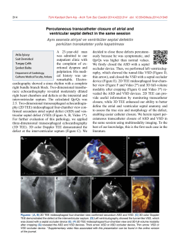 Percutaneous transcatheter closure of atrial and ventricular septal