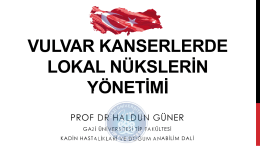 Haldun Güner