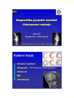 Mikulov 2012 - menisky (PDF - 0,70 MB)