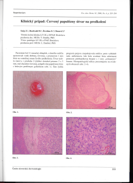Granuloma pyogenicum.pdf