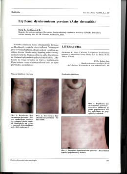 Erythema dyschromicum perstans