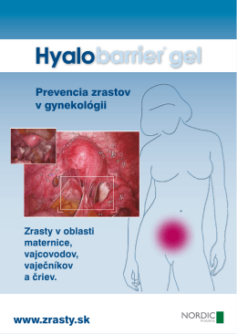 Prevencia zrastov v gynekológii www.zrasty.sk
