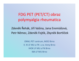 FDG PET (PET/CT) obraz polymyalgia rheumatica