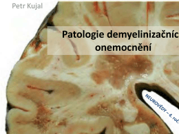 Patologie demyelinizačních onemocnění