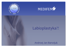 Lobioplastyka – Andrzej Barwijuk