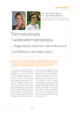 Dermatoskopia i wideodermatoskopia – diagnostyka