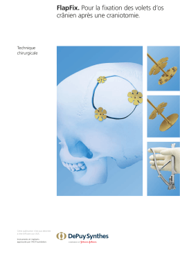 FlapFix. Pour la fixation des volets d`os crânien après une craniotomie.