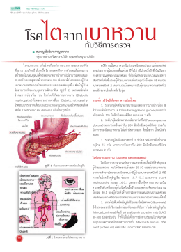 โรคไตจากเบาหวาน กับวิธีการตรวจ