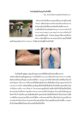 โรค กับสมุนไพรใกล้มือ - สถาบันวิจัยการแพทย์แผนไทย