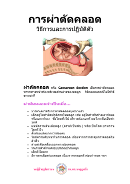 การผ่าตัดคลอด