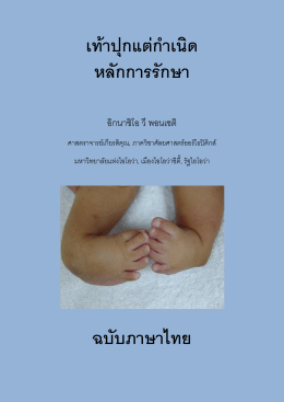 เท้าปุกแต่กาเนิด หลักการรักษา ฉบับภาษาไทย
