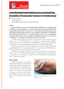 Feasibility of Postauricular Incision for Parotidectomy