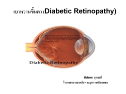 เบาหวานขึ้นตา (Diabetic Retinopathy)