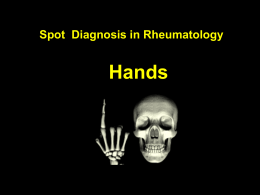 Hands Spot Diagnosis in Rheumatology ชาย 41 ปี มีก้อนที่นิ้วมือ โตขึ้น