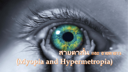 Myopia and Hypermetropia
