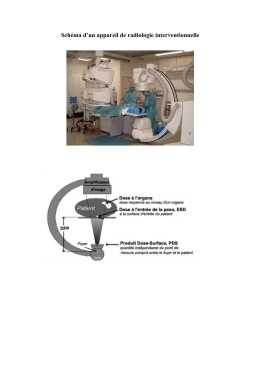 Schéma d`un appareil de radiologie interventionnelle