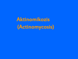 Aktinomikozis (Actinomycosis)