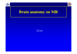 (Microsoft PowerPoint - anatomy brain.ppt [jen pro \350ten\355])