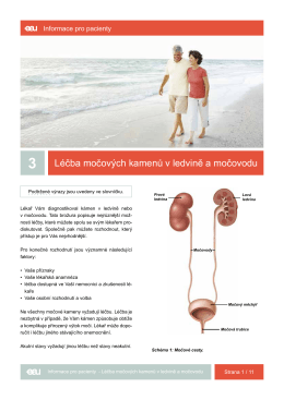 3 Léčba močových kamenů v ledvině a močovodu