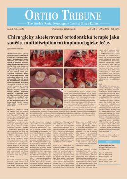 Chirurgicky akcelerovaná ortodontická terapie jako součást