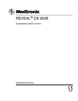 REVEAL® DX 9528