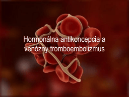 Hormonálna antikoncepcia a venózny trombebolizmus