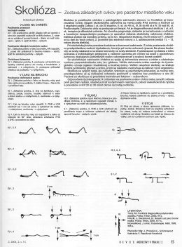 Skolióza - zostava cvikov pre pacientov mladšieho veku - Fit-Care