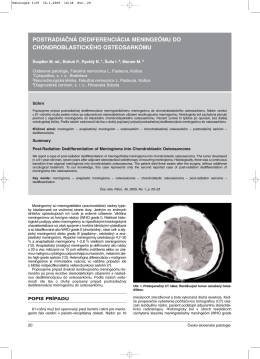 postradiačná dediferenciácia meningeómu do chondroblastického