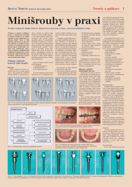 Minišrouby v praxi - Dental Tribune International