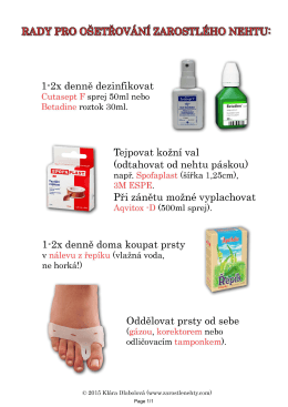 rady pro o&scaron;etřov&aacute;n&iacute; zarostl&eacute;ho nehtu