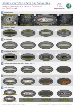 ultrazvukový popis patologií endometria