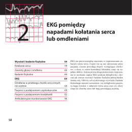 EKG pomiędzy napadami kołatania serca lub omdleniami