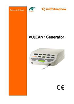 Vulcan_Operační technika