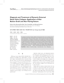 Diagnosis and Treatment of Dynamic External Nasal Valve Collapse