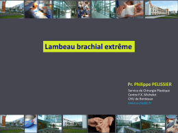 Lambeau brachial extrême - e
