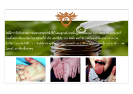 สมาคมโฮมีโอพาธีย์ประเทศไทย แจกยาป้องกันโรคมือ เท้า ปาก