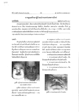 การดูแลวักษาผูป่วยปากแหวงเพดานโหว