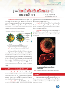 โรคไวรัสตับอักเสบ C