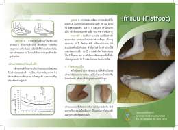 เท้าแบน - สถาบันสุขภาพเด็กแห่งชาติมหาราชินี