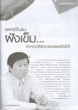 แพทย์จีนแนะ ฝังเข็ม...อีกหนึ่งวิธีรักษารอยแผลเป็นได้ดี
