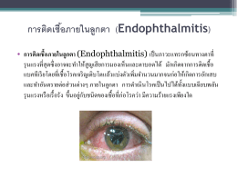 การติดเชื้อภายในลูกตา (Endophthalmitis)