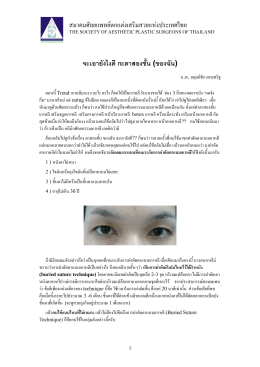 จะเอายังไงดี กะตาสองชั้น - สมาคมศัลยแพทย์ตกแต่งเสริมสวยแห่งประเทศไทย