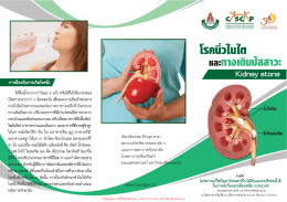 Kidney stone โรคนิ่วในไตและทางเดินปัสสาวะ