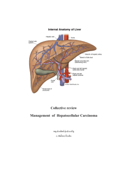 Collective review Management of Hepatocellular Carcinoma