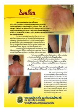 แผ่นปลิว ให้ความรู้เกี่ยวกับโรคเรื้อน