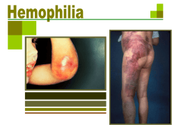 haemophelia