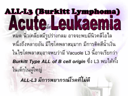 ALL-L3 (Burkitt Leukemia)