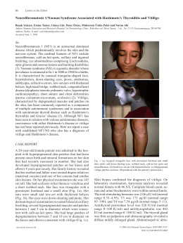 Acta Dermato-Venereologica - Neurofibromatosis 1/Noonan