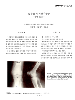 Page 1 大韓膝關節學會誌·第4卷,第1號 Vol. 4, No. 1, June 1992 인제