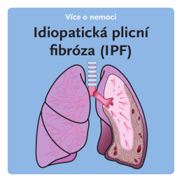 Idiopatická plicní fibróza (IPF)